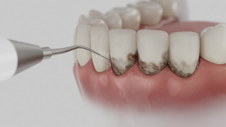 Trusted Emergency Dentist service in Clermont, GA - Dentist Open Now
